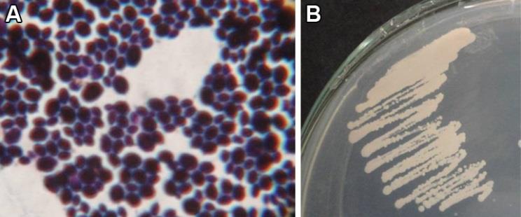 Candida auris under a microscope